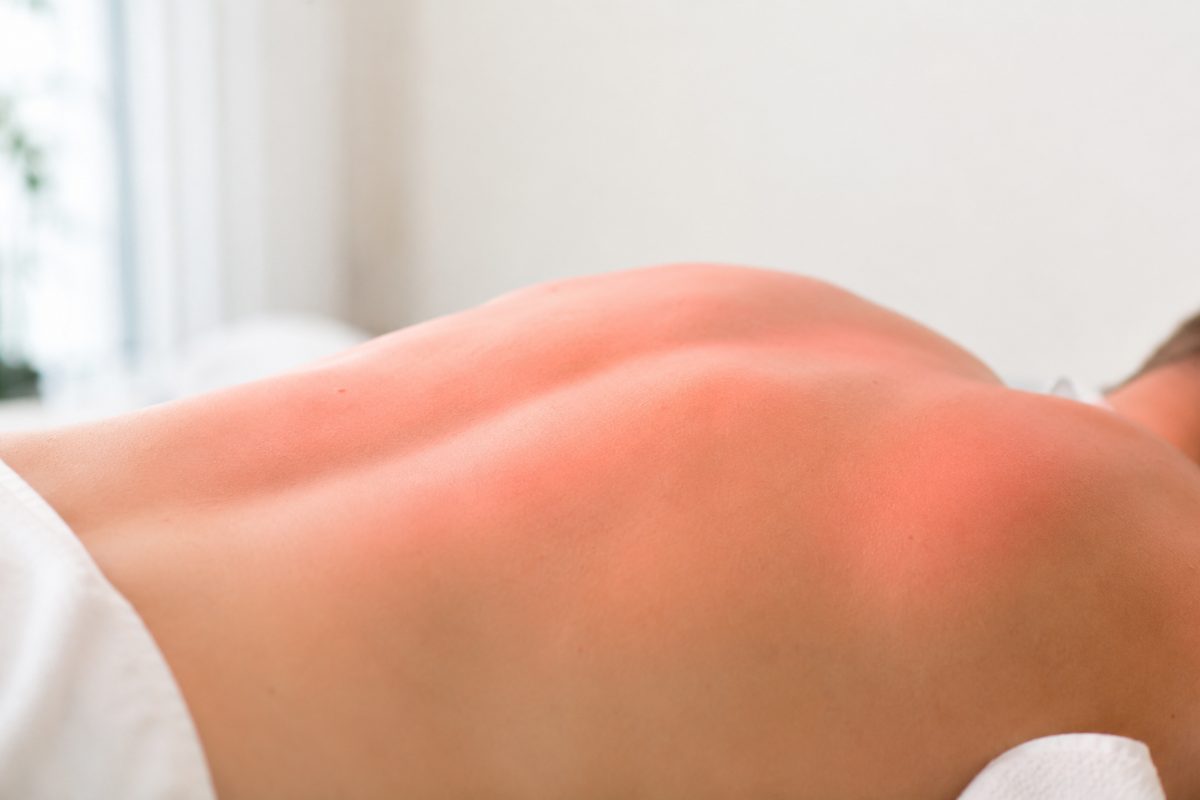 Wärmebehandlung mit Rotlicht am Rücken